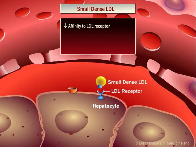 How Lipoproteins Affect Metabolism in Diabetes