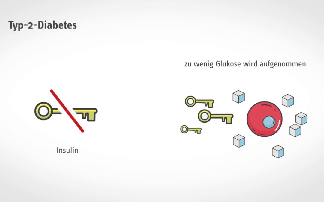 Kurz und verständlich: Was passiert bei Diabetes?