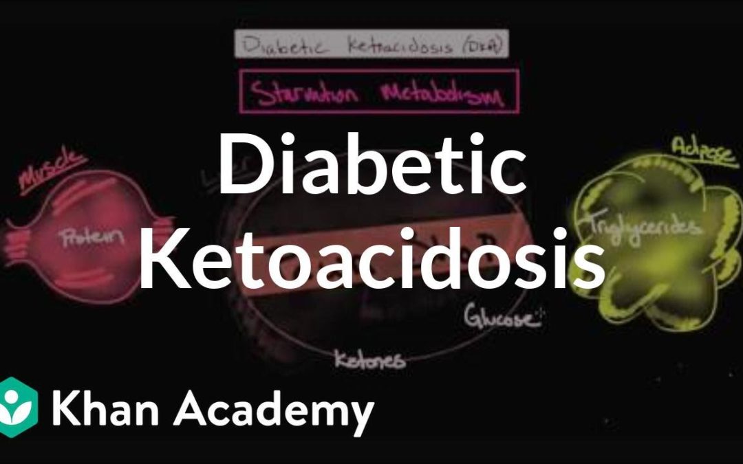 Acute complications of diabetes – Diabetic ketoacidosis | NCLEX-RN | Khan Academy
