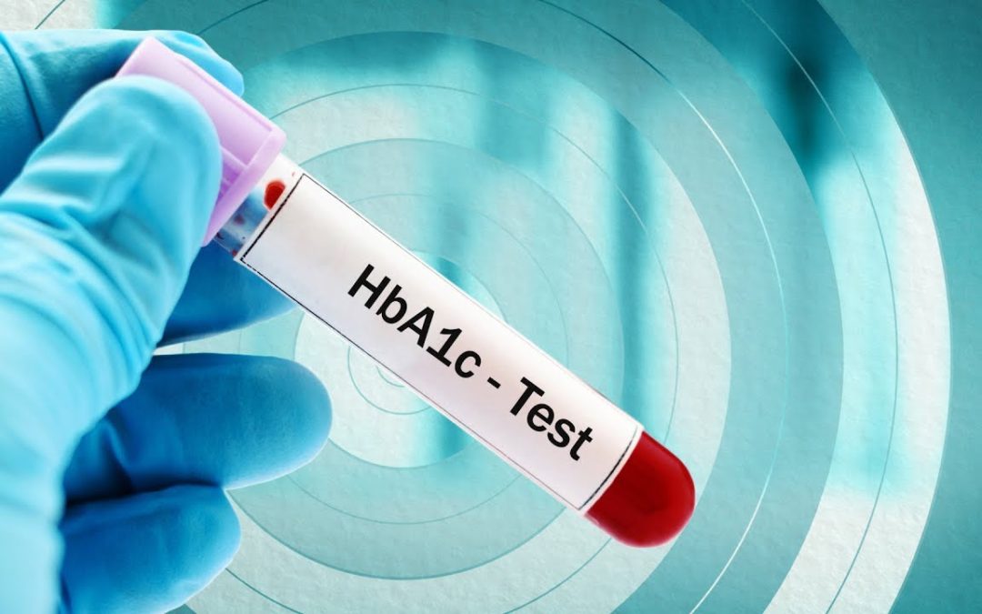 What is the Optimal HbA1c Target for Type 2 Diabetes Patients?