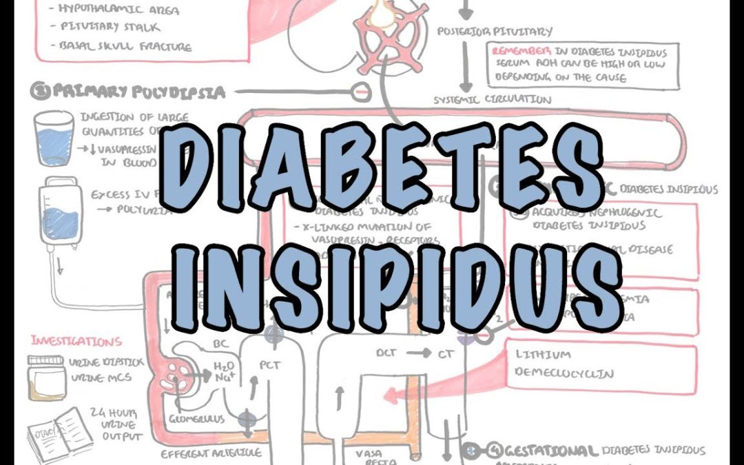Diabetes Insipidus – Overview (causes, pathophysiology, investigations)