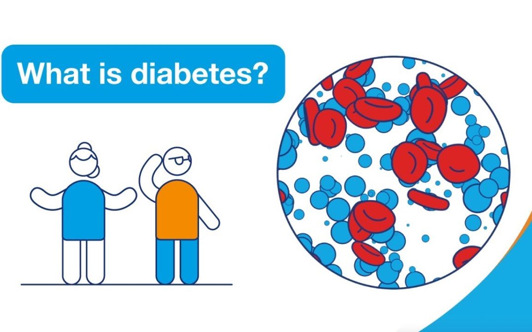 What is diabetes? | Diabetes UK