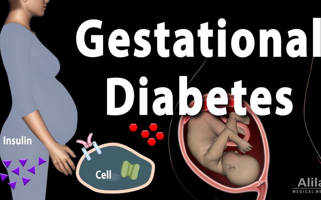 Gestational Diabetes, Animation