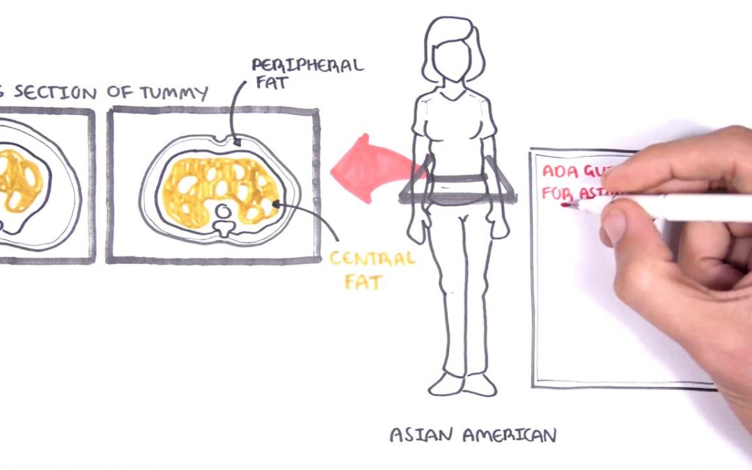 ADA New Diabetes Screening Guidelines