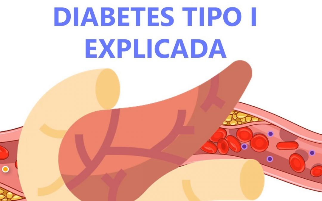 Diabetes tipo 1 – Explicado Fácilmente Para Pacientes