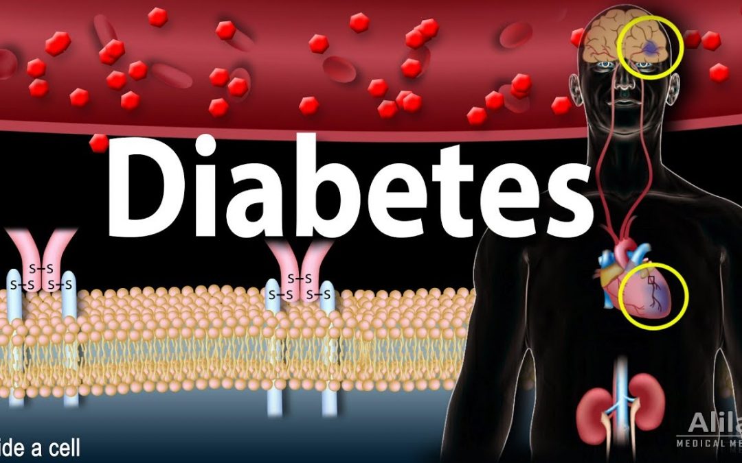 Diabetes mellitus – Symptoms, Complication, Pathology of Type 1 and Type 2, Animation