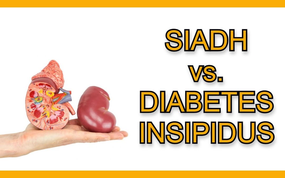 SIADH vs. Diabetes Insipidus