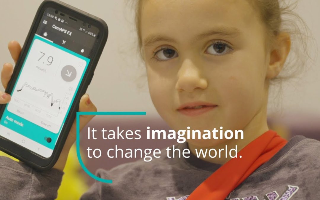 Artificial Pancreas Helping Children With Type 1 Diabetes