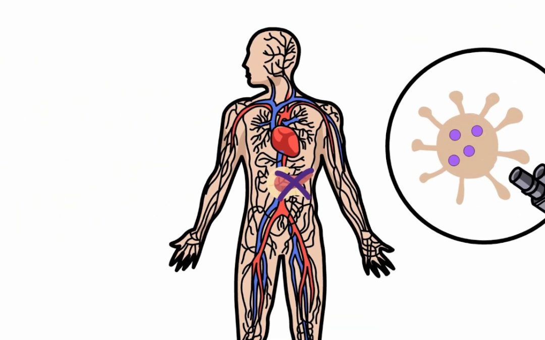 La diabetes – ¿Qué es la diabetes? Video para pacientes