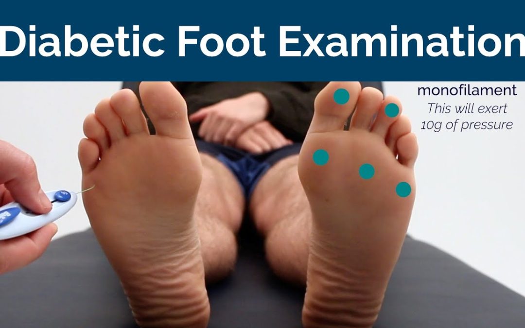Diabetic Foot Examination – OSCE Guide (NEW)