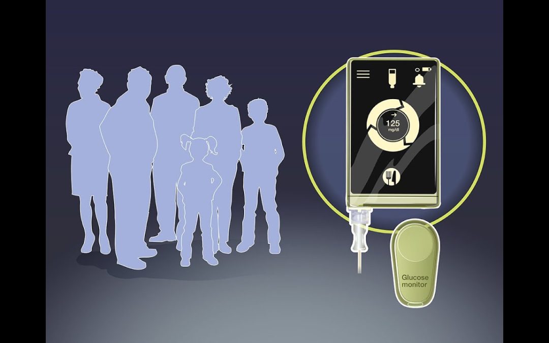 Quick Take: Bionic Pancreas in Type 1 Diabetes