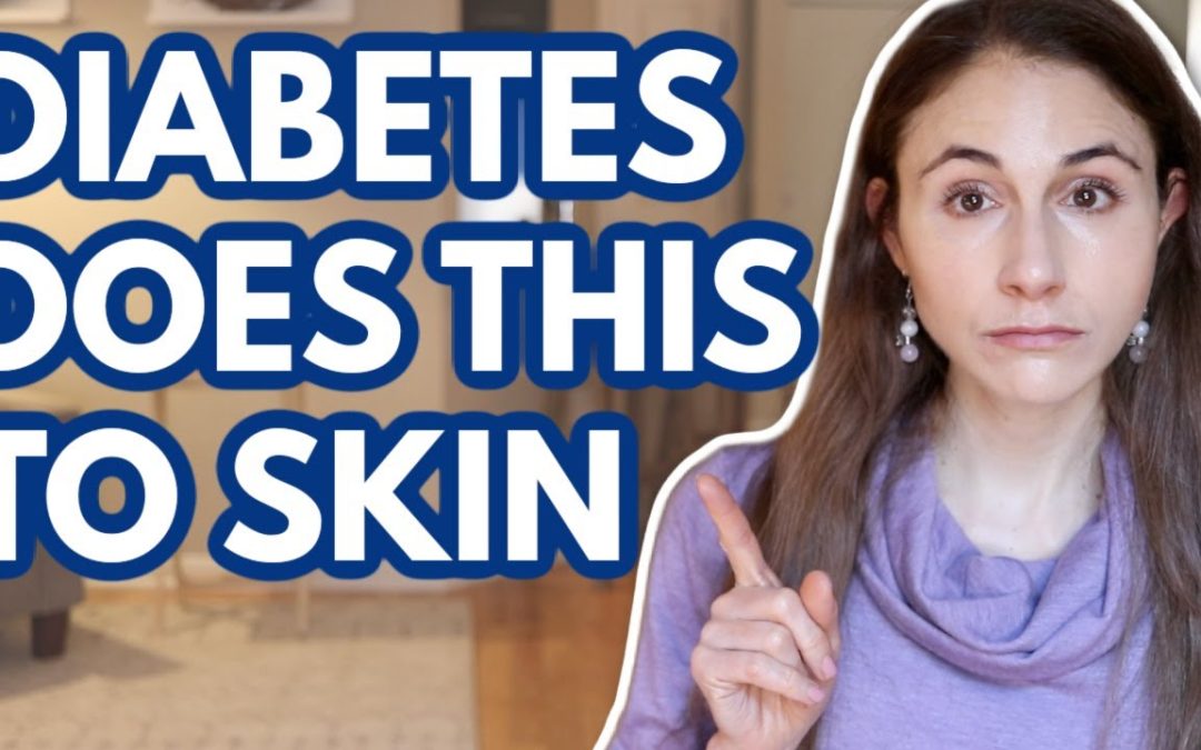 WHAT DIABETES DOES TO YOUR SKIN // DERMATOLOGIST @Dr Dray