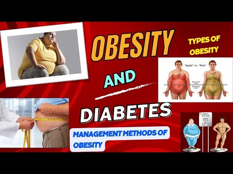 Obesity and Diabetes, Types and Management of Obesity